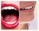 Slider image (10) Clinica Gadea Ramirez | Dental Services